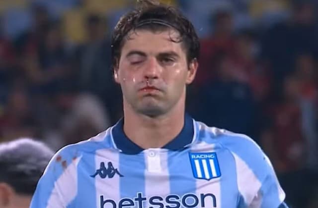 Sosa sofre fratura no maxilar e deve desfalcar o Racing diante do Flamengo