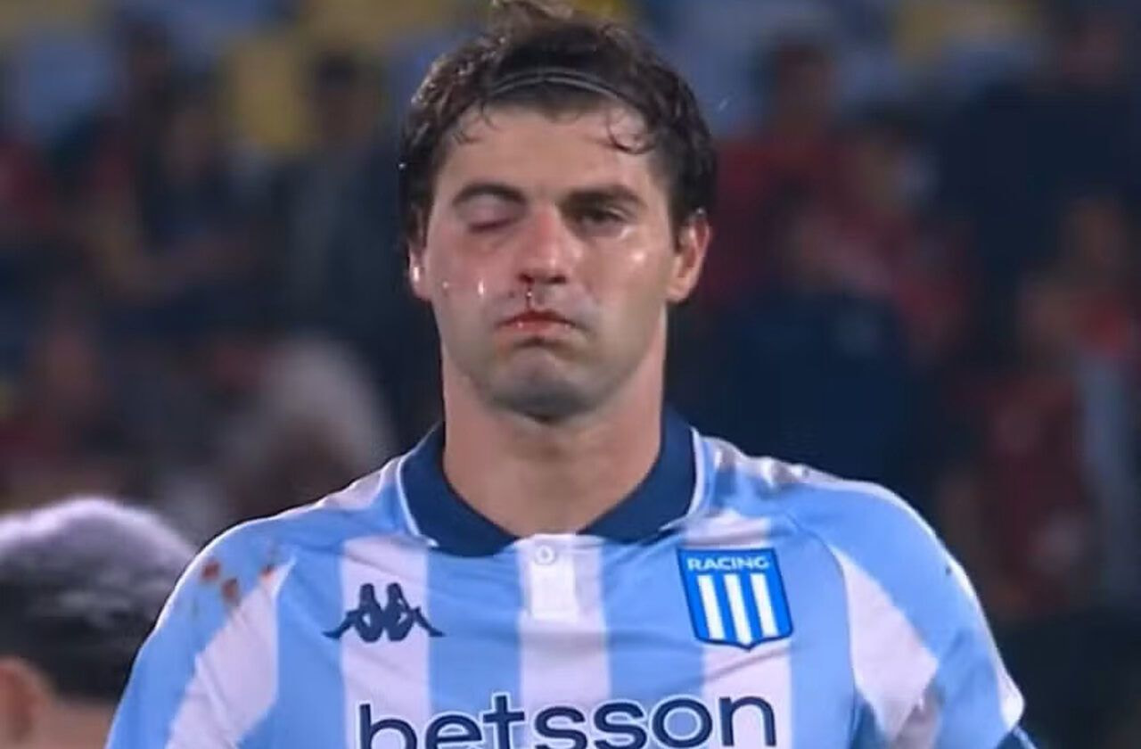 Imagem da noticia Sosa sofre fratura no maxilar e deve desfalcar o Racing diante do Flamengo
