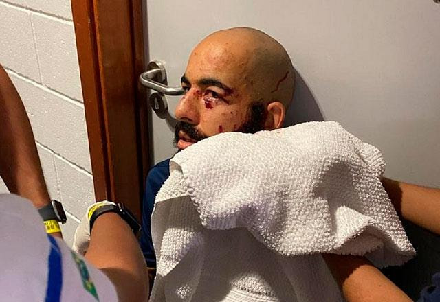 Imagem da noticia Vítima de atentado em fevereiro, goleiro do Bahia ainda retira vidro do corpo