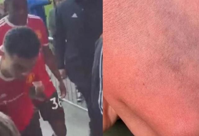 Imagem da noticia Mãe de torcedor do Everton acusa Cristiano Ronaldo de agressão