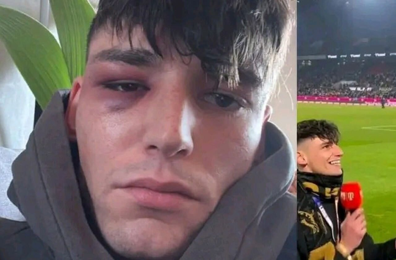 Imagem da noticia Árbitro é agredido após pedir namorado em casamento durante jogo da Bundesliga