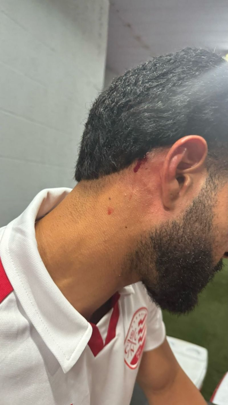 Imagem da noticia Massagista do Náutico é atingido por pedra após Clássico dos Clássicos