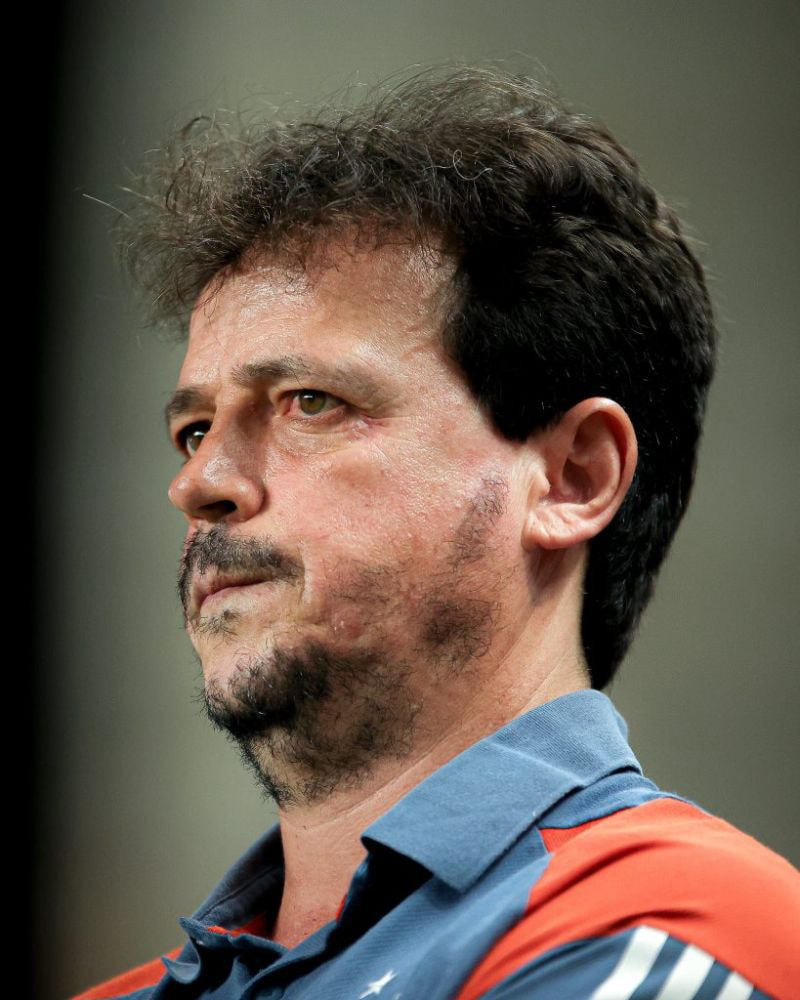 Imagem da noticia Fernando Diniz avalia derrota para o Flamengo: "Falta consistência"